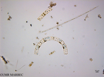 phyto/Guinea golf/Wouri_estuary_ZD-ZD1-ZD2-ZD3/YNkouefuthNfongmo_these 2022-2023/Dactyliosolen blavyanus et Pseudo-nitzschia seriata complex et Guinardia striata et Cerataulina sp3 et Cylindrotheca closterium (ZD2_SURF_2023_pseudonitzschia230613_001_ovl 1).TIF(copy)_thumb.jpg
